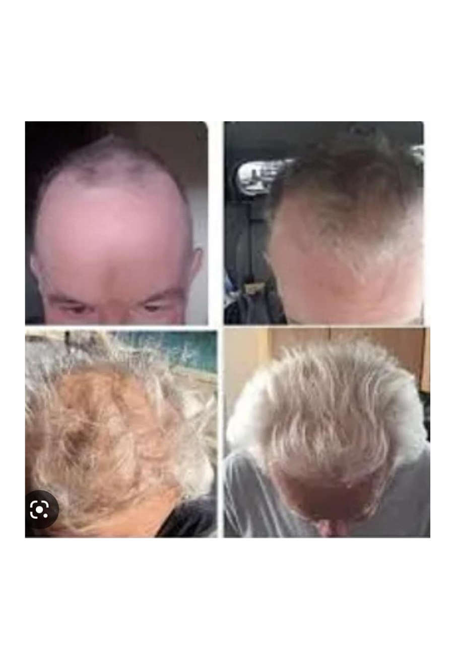 Strona 5 – Fototerapia Ogrody Spa