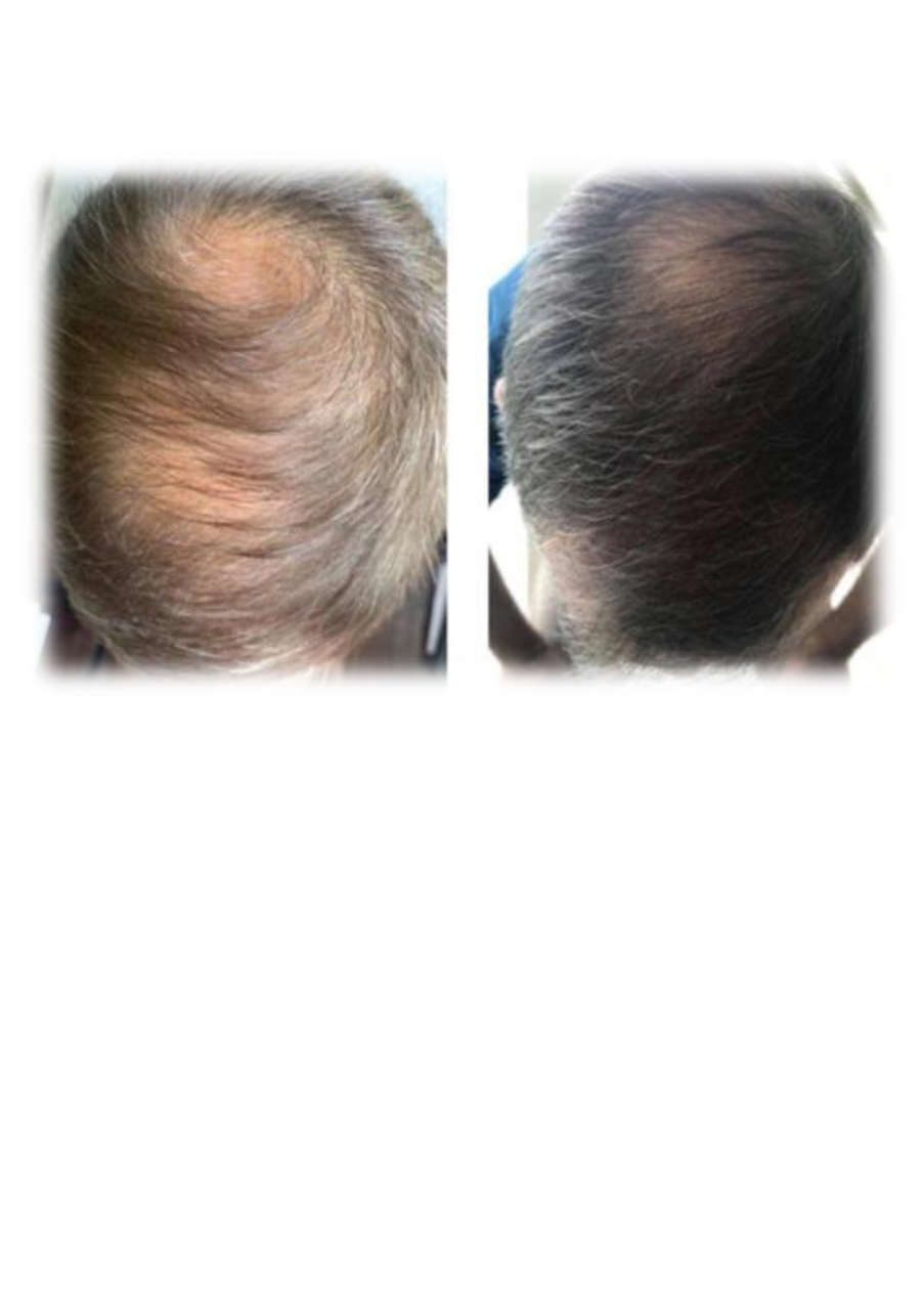 Strona 6 – Fototerapia Ogrody Spa