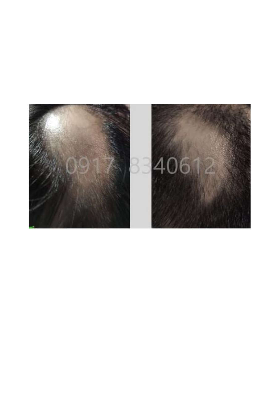 Strona 7 – Fototerapia Ogrody Spa